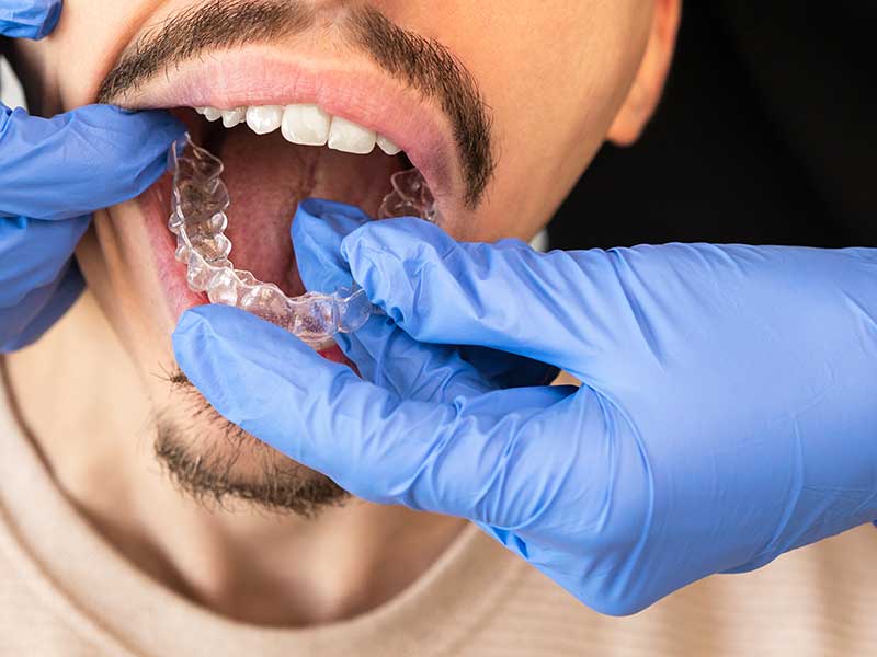 La ortodoncia invisible actual ofrece más opciones, ven a Clínica dental Carlos Sáiz en Chamartín y calle Serrano en Madrid